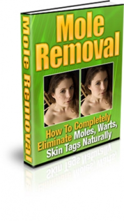 Mole Removal